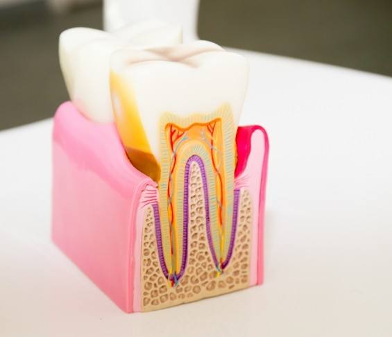 Model of tooth showing root canals inside of it