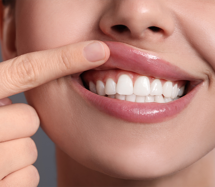 Close up of a person pointing to their smile after lightening darkened teeth in Jersey City