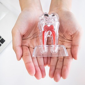 Holding plastic see-through model of tooth