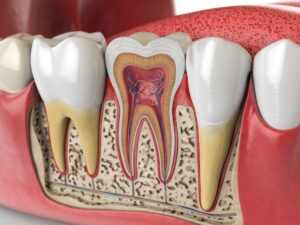 Diagram showing several teeth with one that's cross sectioned to show nerves inside